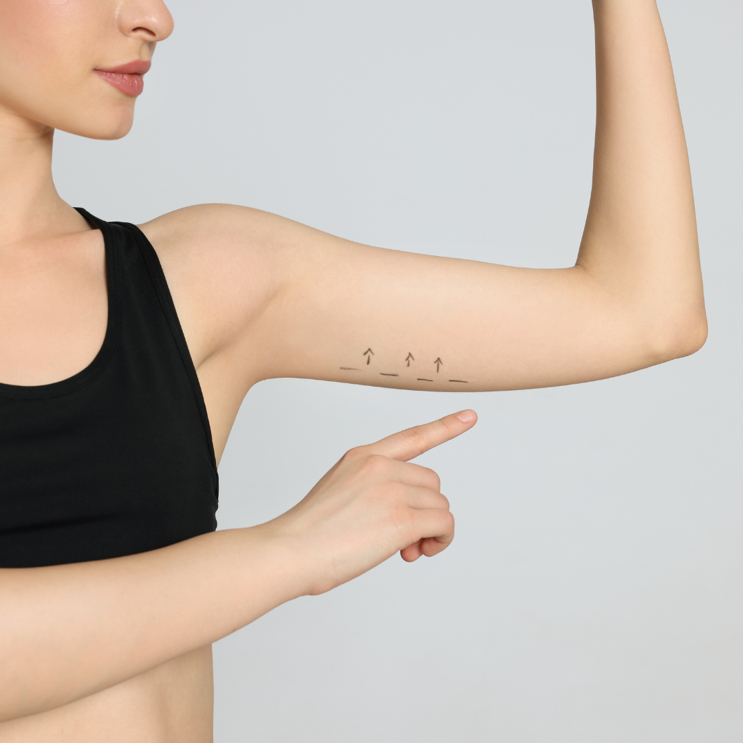 arm lift surgery in Baltimore
