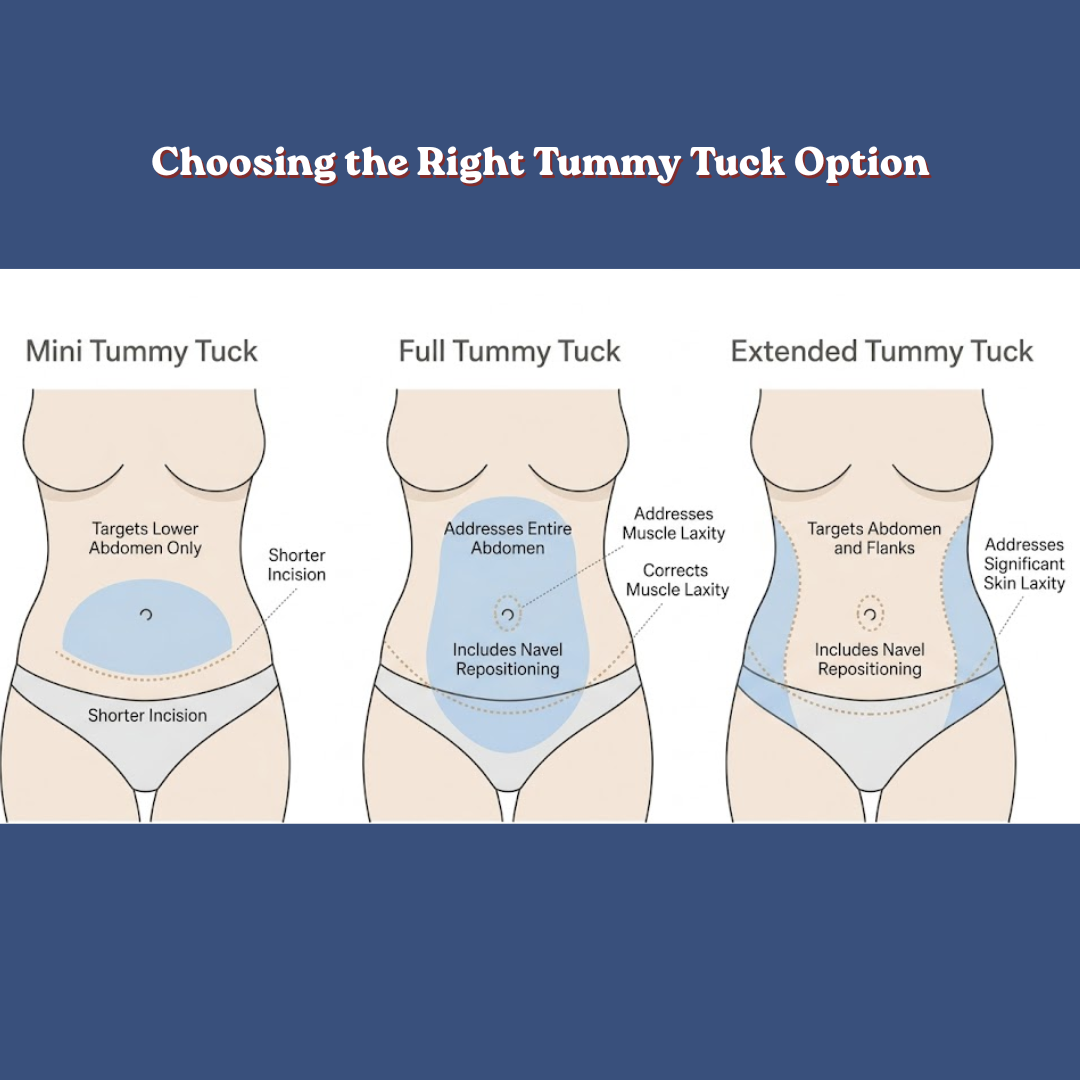 tummy tuck in Baltimore