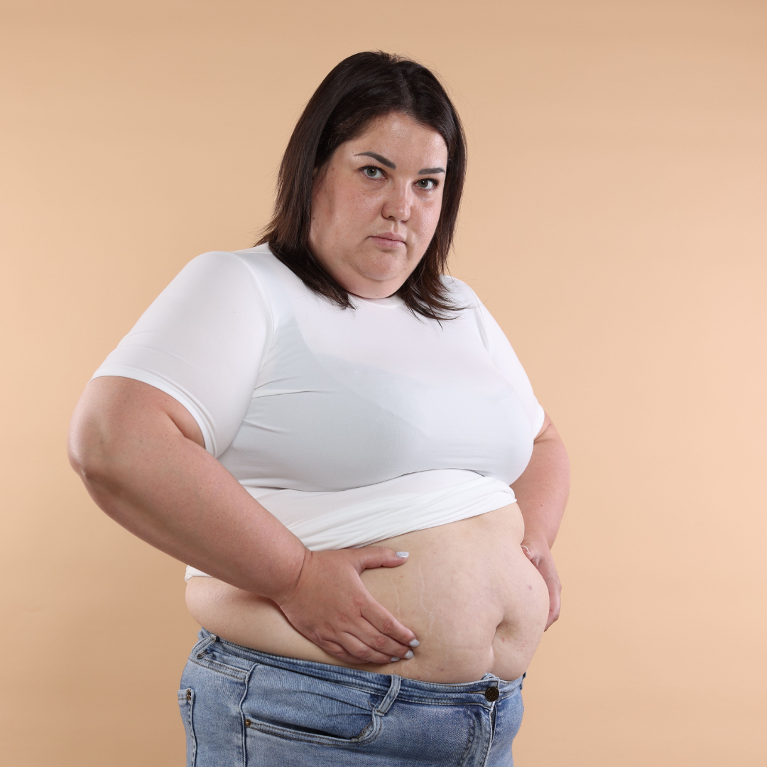 liposuction in Maryland